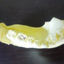 歯の衛生週間^^