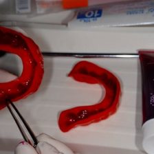 Dental Drug Delivery System (3DS) ~齲蝕編~